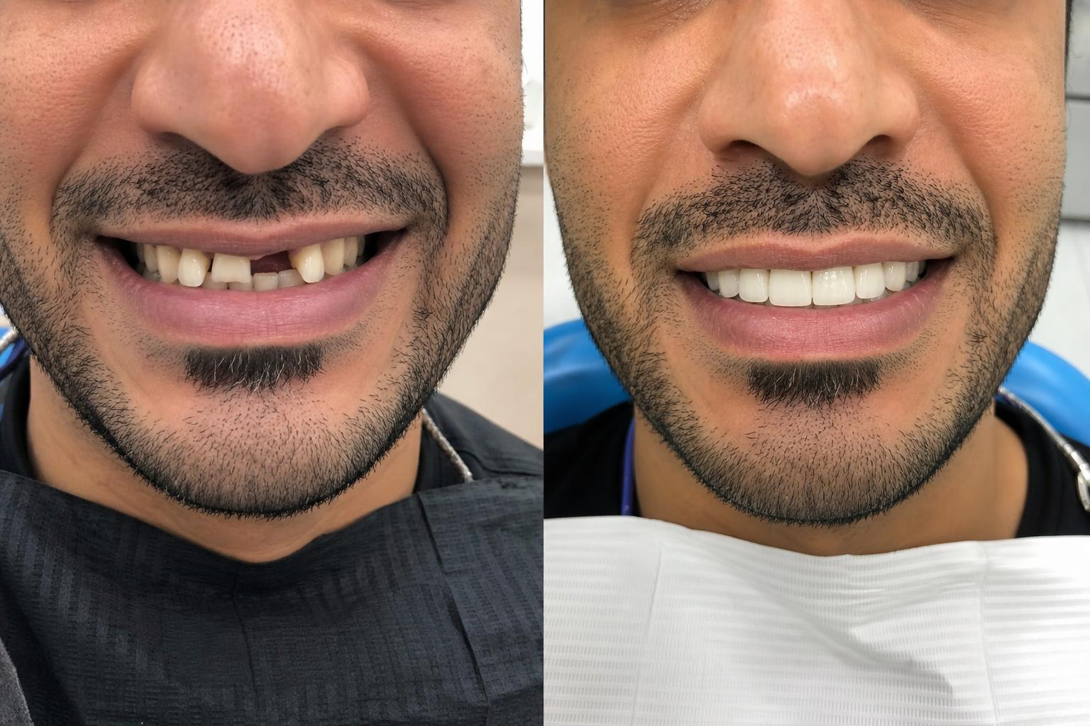 تركيبات تجميلية
